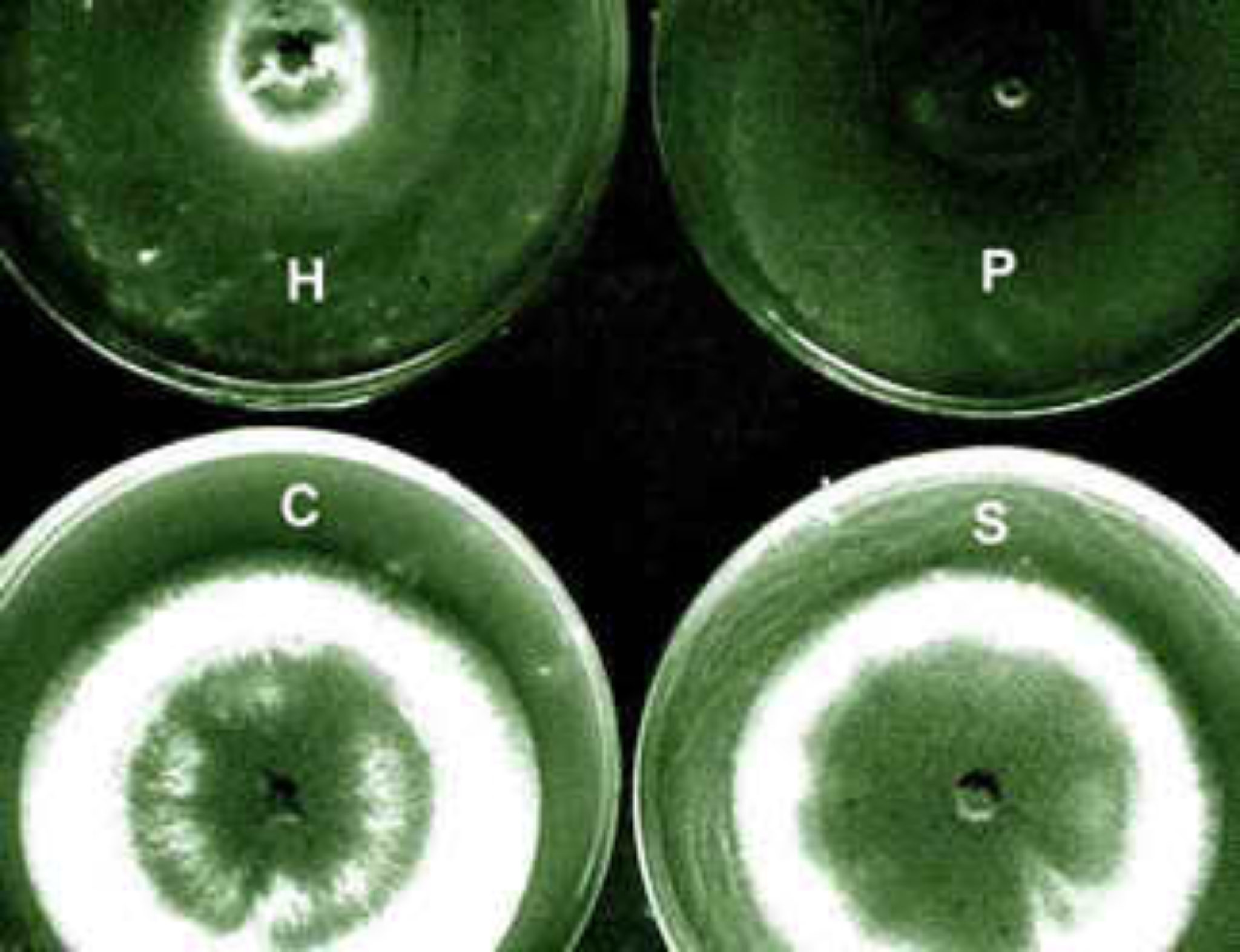 A. fumigatus Archives - Page 8 of 10 - Aspergillus and Aspergillosis