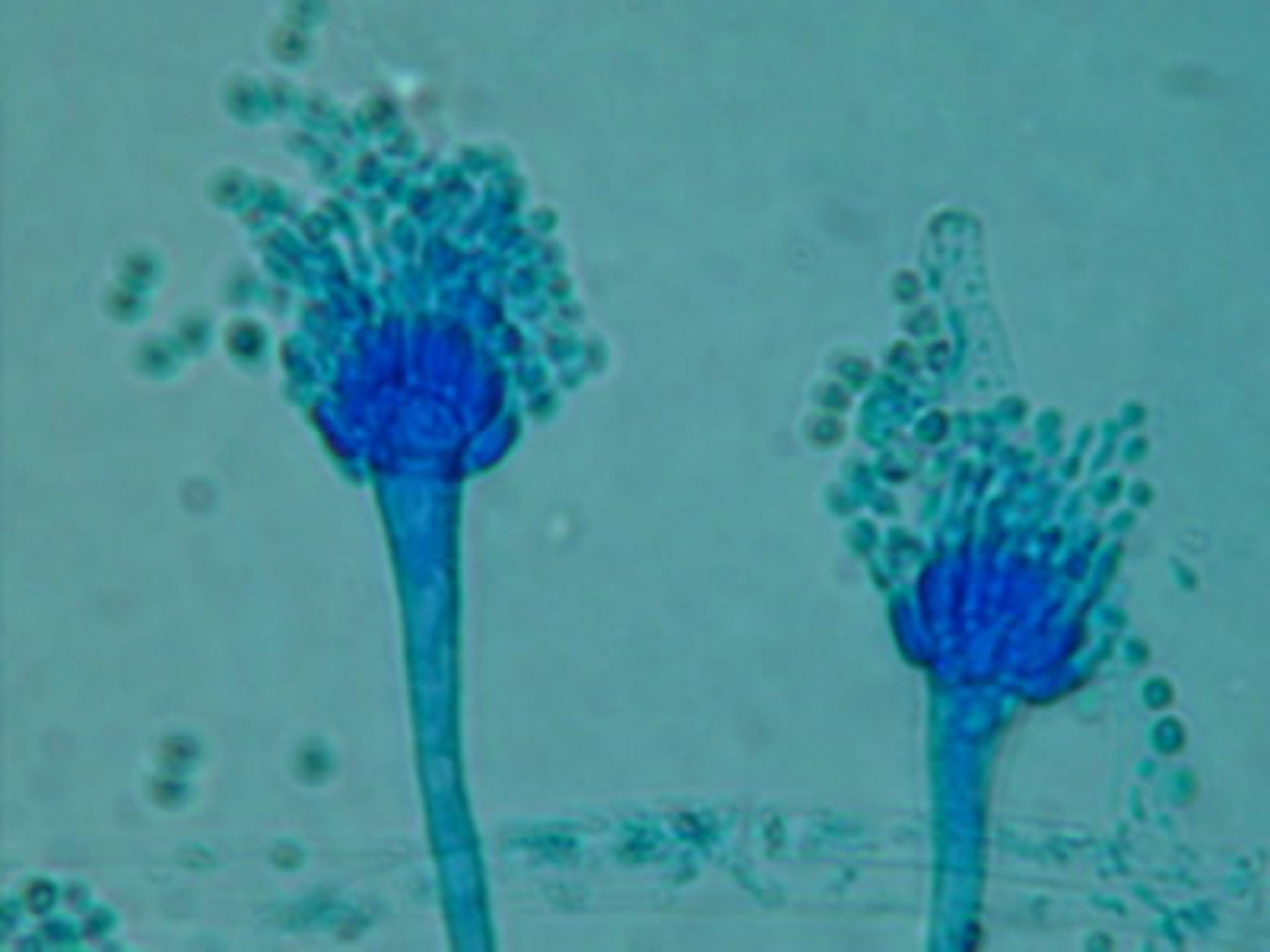 A. fumigatus Archives - Page 9 of 10 - Aspergillus and Aspergillosis