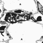 alveolbEP