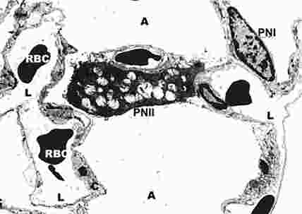 alveolbEP