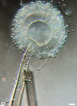 Aspergillus conidiophores