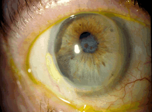 eye8ATullo