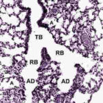 lungPC