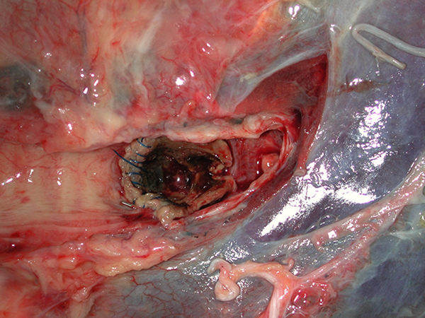 Fig2 Left main bronchus 