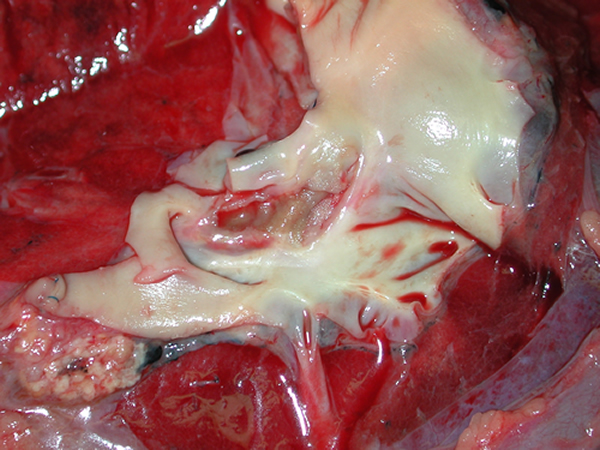 Fig3 Pulmonary artery 