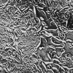 An electron micrograph of amphotericin B lipid complex