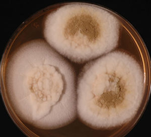 Image A. Culture of Aspergillus ochraceopetaliformis on Sabouraud agar with cycloheximide at 26C