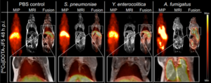 MRI and fused PET/MRI images showing increased uptake of tracer in A. fumigatus-infected lung tissue compared with controls.