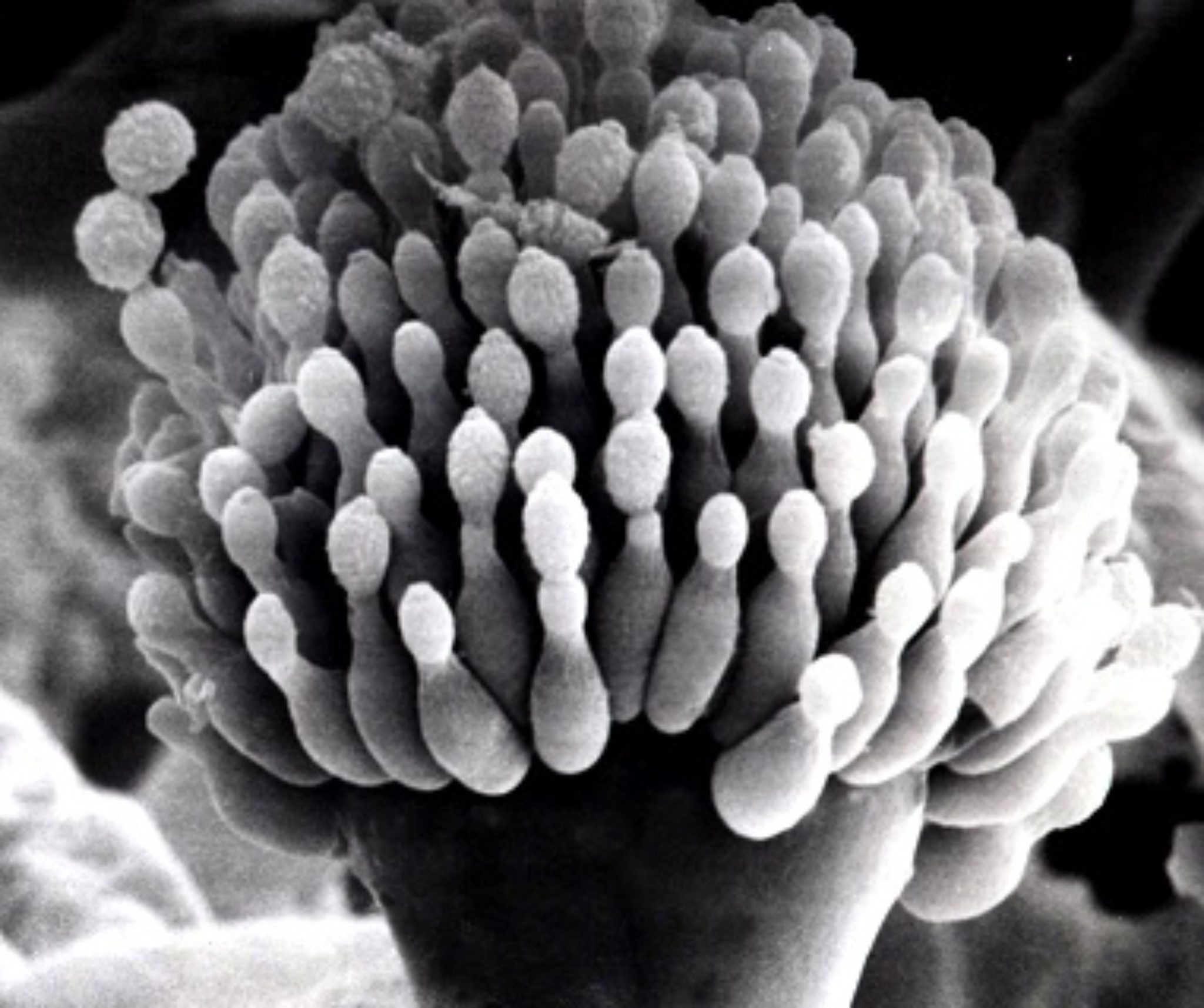 A. fumigatus Archives - Aspergillus and Aspergillosis