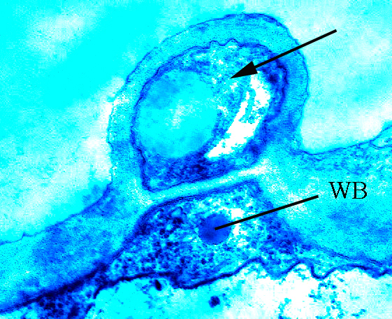 A terreus aleurospore TEM in vitro (РКПГF-1275)