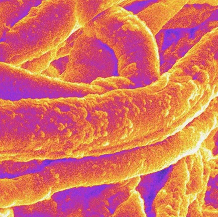 Electron Microscopy: Aspergillus fumigatus - Aspergillus and Aspergillosis